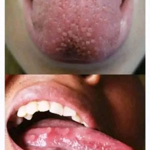 These are the consequences of eating …See more